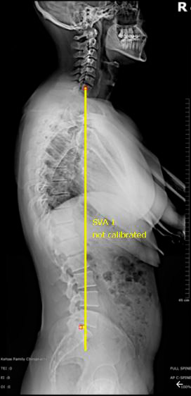 Fig. 1 equilíbrio sagital